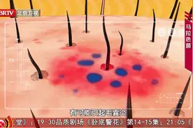 头皮上摸到“小疙瘩”，或是疾病信号，别大意！教你4招养好头皮图片