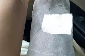 玻璃杯炸裂致深二度烫伤，网购9块9两个的廉价玻璃杯竟有这些风险图片