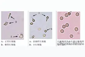 尿液不像看上去那么纯净，里面的东西你见过？图片