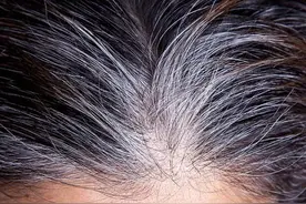 白头发太多怎么办？正确的染发小妙招，能把对身体的危害降到最低图片