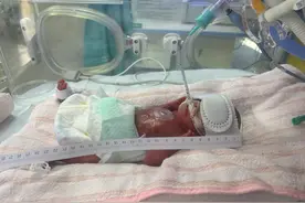 “临时爸妈”90天救回“巴掌宝宝”，协和医院屡创超早产儿救治生命奇迹图片