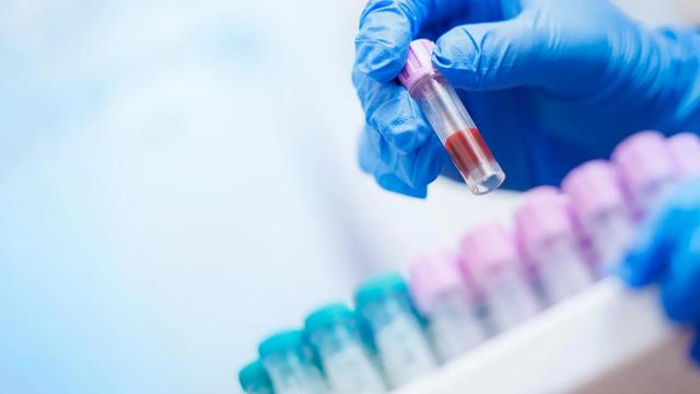 科学家将AI应用在日常血液检查中，帮助医生找到挽救生命的线索