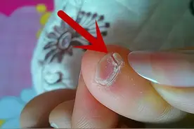 小脚趾指甲分成两瓣的人，到底什么来历？是纯种汉族人的证明吗？图片