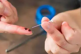 手上扎刺了怎么办？学会这几个小妙招，就能轻松把刺取出来图片