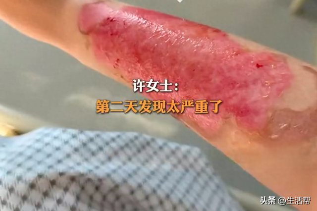 火锅店老板回应滑倒烫伤顾客：提出支付治疗费用6000元，再赔偿1万元，对方不同意