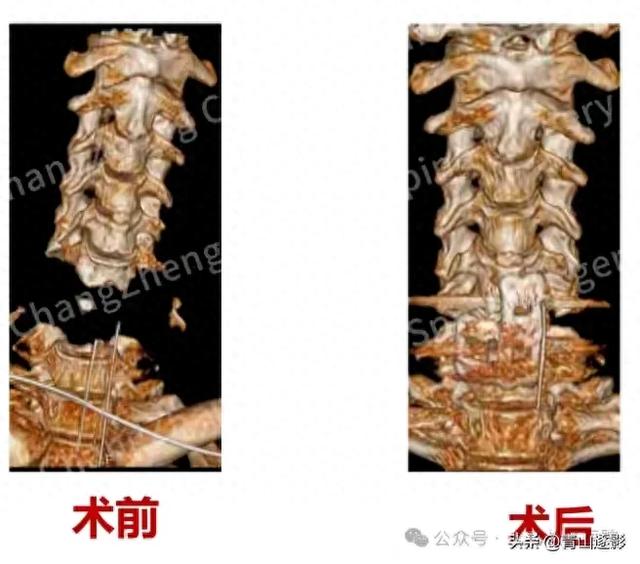 奇迹再次上演！上海长征医院改写医学史让全球医学界震惊