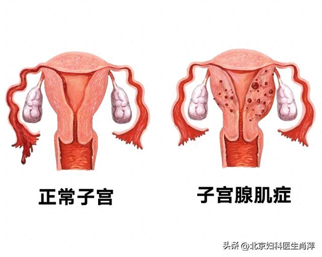 我昨天刚带的环今天感觉有点不适（戴曼月乐环后）