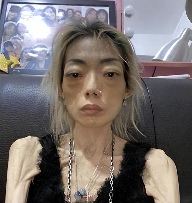 豪门玩物，8年被折磨成牙齿全掉，不足80斤，形似骷髅，惨不忍睹