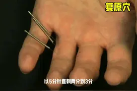 董氏奇穴之复原穴，主治骨膜炎，骨肿大，骨刺，坐骨神经痛等图片