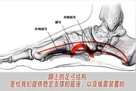 鞋子顶足弓究竟是好与坏？适合扁平足吗？ #足弓支撑图片