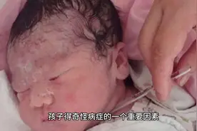 为什么现在儿童奇怪的疾病越来越多？图片