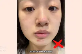 坚持刮痧的1个多月…面部状态居然是这样的！图片