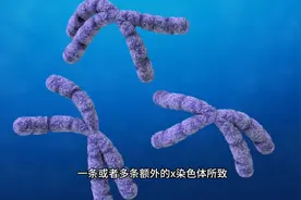 多一条Y染色体是超雄，多一条X染色体会变成什么呢？是男是女？图片