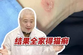 养猫的朋友注意了！手臂上长小红圈，赶紧治！会传染！ #体癣 #猫癣 #抖出健康知识宝藏  #真菌感染 #痒视频封面