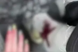 游客称在玉龙雪山被蚂蝗叮，脚部出血渗出鞋子，景区：蚂蝗是自然现象，准备了消毒酒精#媒体精选计划 #玉龙雪山 #蚂蝗 #血