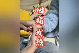 咽痛，发热 #发热 #中医 #放血疗法 #硬核健康科普行动  #2024都有好好爱自己