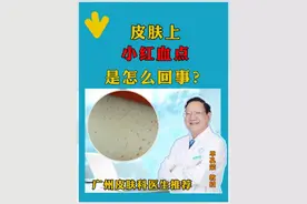 皮肤上小红血点是怎么回事？ #医疗小常识 #银屑病小知识 #广东皮肤病医生推荐 #单孔荣医生 #硬核健康科普行动视频封面
