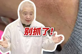 脖子上反复长红斑，痒，忍不住抓❗这是#神经性皮炎 ，医生教你正确处理#抖出健康知识宝藏  #科普 #情绪 #开工去班味健康指南