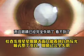 8岁孩子黑眼珠变“白”，险些完全失明，医生提醒：这类孩子尽早检查！ 视频封面