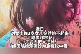 比砒霜还毒！#湖南3岁女童大把脱发确诊铊中毒  成人致死量仅10～15 mg/kg！#铊 #身体健康