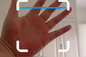 女子“晒手”被网友提醒查肝功能，谁料一查还真被网友说准了#手掌 #肝掌视频封面