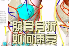 髌骨骨折如何康复？按摩推拿及时介入并注意活动下肢预防血栓。视频封面