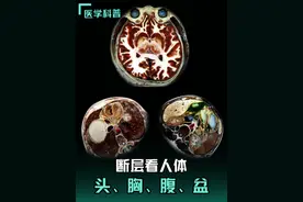 断层看人体，头、胸腔、腹腔、盆腔