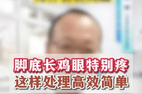 脚底长鸡眼，为什么，怎么办？#鸡眼 #脚痛 #骨科陈超 #扁平足 #老茧