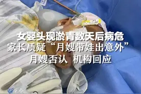 女婴头现淤青数天后病危 ，家长质疑“月嫂带娃出意外”， 月嫂否认，机构回应
