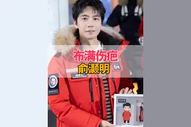 被一场爆炸戏断送花美男之路，下巴至今布满伤疤的俞灏明，生活怎么样了？#俞灏明 #王晓晨 #俞灏明烧伤毁容 #俞灏明王晓晨 #一起来看流星雨