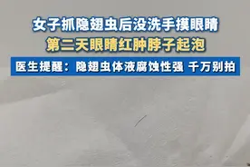 #女子抓隐翅虫后没洗手摸眼睛  第二天眼睛红肿脖子起泡 #隐翅虫 #女子 #湖南dou知道视频封面