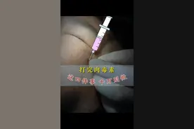 打完肉毒后这四件事千万别做 打完肉毒后这四件事千万别做#肉毒素 #北大眼整形周常青 