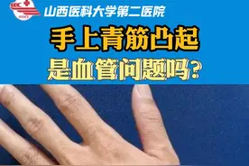 手上青筋凸起是怎么回事？是血管问题的信号吗？一起来揭秘啦#血管 #血栓 #医学科普