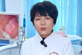 #口腔科普 #脸肿 #含牙囊肿 脸突然肿起来，怎么办？？？视频封面