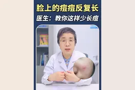 脸上的痘痘反复长，皮肤科医生教你正确处理，让你少长痘#痘痘 #医学科普 #痤疮 #抖出健康知识宝藏 #祛痘