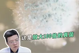 让你脚趾缝发痒发臭的罪魁祸首像棉花糖？教你两步对付它#真菌#脚气 #脚臭 #脚痒 #回南天 #抖出健康知识宝藏视频封面