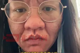 5月27日（采访时间）云南昆明。一女子分享自己怀孕前后的容貌变化，当事人李小姐表示自己从孕期第五个月开始鼻子才变大。在生完宝宝以后身体、容貌也开始逐渐恢复：“虽生育过程很辛苦，但看到宝宝后还是觉得挺值得的。”@💫李是木子李 #孕激素 #女子分享孕期分娩后容貌变化