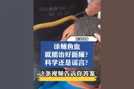 涂鳝鱼血就能治面瘫？究竟是科学还是谣言？ #面瘫 #面瘫患者 #面瘫后遗症 #面瘫一般多久恢复正常 #医学科普视频封面