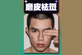 适合初学者或者新手的人像磨皮小技巧#p图教程 #ps技能 #ps人像精修人脸步骤 #修图前vs修图后 #p图前后