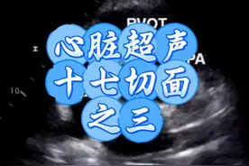 胸骨旁短轴主动脉瓣-大血管短轴水平切面：心脏超声十七切面之三