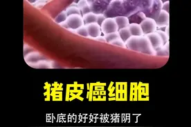 猪基因病毒做成抗癌导弹 癌细胞顶贴猪标签被免疫系统全歼 #癌症 #癌细胞 #医疗 #猪皮 #癌症治疗