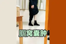 腘窝囊肿伴酸痛 保守治疗，注意休息和保暖 #腘窝囊肿怎么办 #膝关节不舒服 #膝关节保护 #医疗健康创作训练营 #抖出健康知识宝藏视频封面