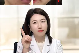 挑战用一支药膏，解决身上的痘痘！#痘痘 #毛囊炎 #后背痘痘 #科普 #痘痘黑头粉刺拜拜