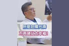 肝脏包膜已光滑，患：没有肝硬化生活太幸福！ #肝硬化 #肝病专家郭朋