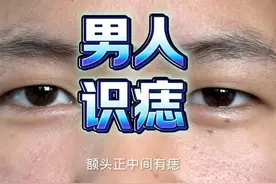 男人身上的痣代表什么#痣 #面相 #男人 #传统文化 #国学