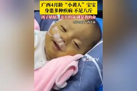 #4月龄小黄人宝宝身患多种疾病  ，体重不足八斤，孩子姑姑：亲人的命，就是我的命！目前孩子正在从广西转运到北京接受治疗。