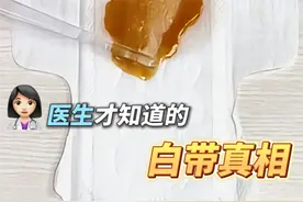 医生教你30s自查白带，这才是女生的必修课！#白带#女性#女性健康#女生必看#硬核健康科普行动