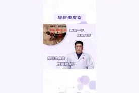 隐翅虫皮炎如何防治？#医学科普 #健康科普 #皮肤 #医生 #皮肤李博士 视频封面