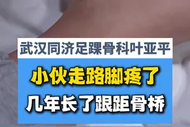 小伙长了跟距骨桥,走路疼了好几年都没发现 #跟距骨桥  #脚疼 #硬核健康科普行动 #踝关节