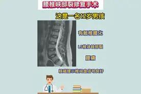 腰椎峡部裂修复手术 #医学科普 #腰椎 #峡部裂